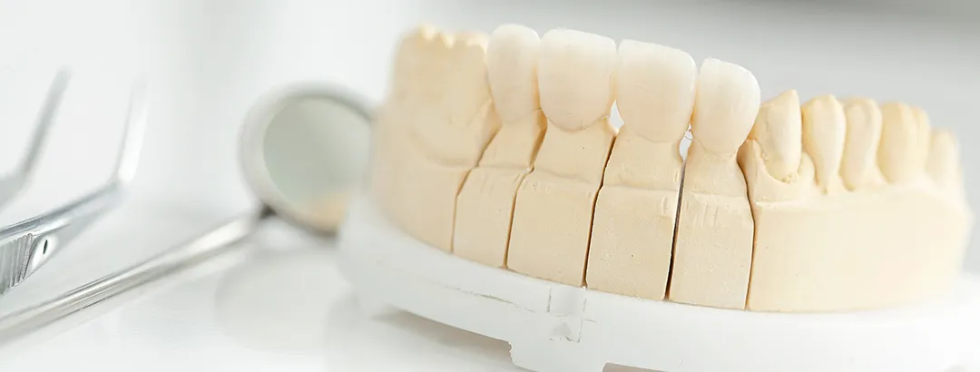 当院のセラミック治療