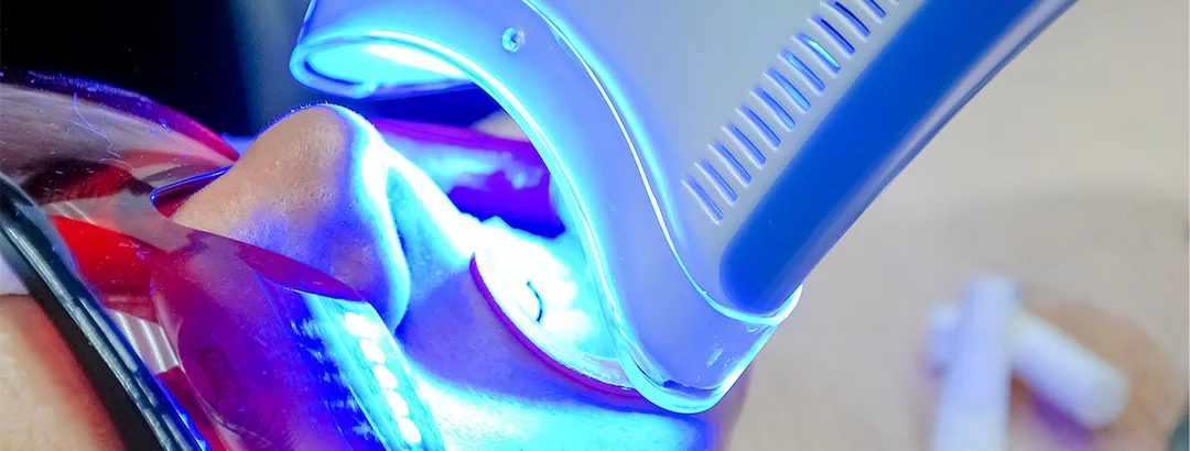 オフィスホワイトニング