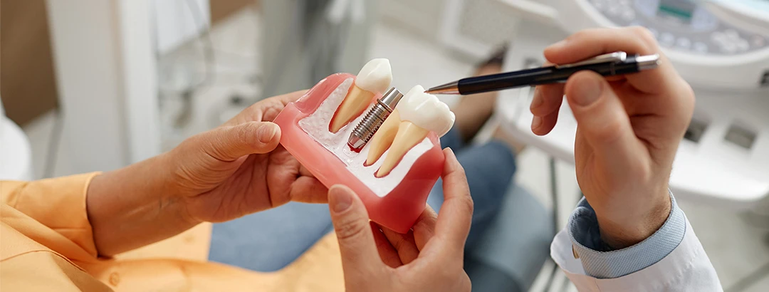 インプラント治療の経験と技術を積んだ医師が在籍