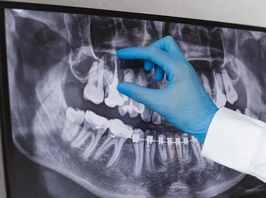 歯科用CT・デジタル設備による精密な診察