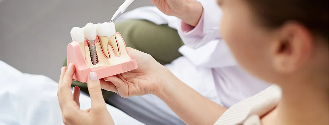 インプラントを長く使うために