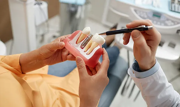 インプラント治療の経験と技術を積んだ医師が在籍