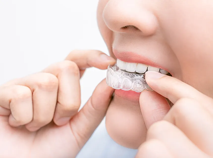 マウスピース型矯正装置（インビザライン）を中心とした矯正治療