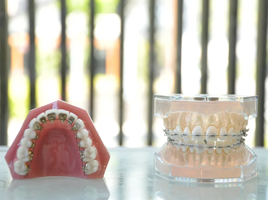 口腔全体を考えた総合的な治療計画