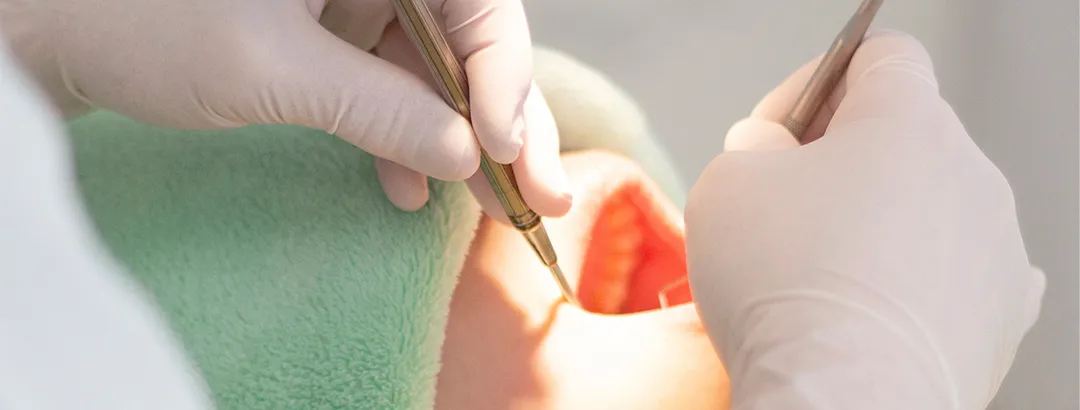 プロケアからセルフケア指導まで